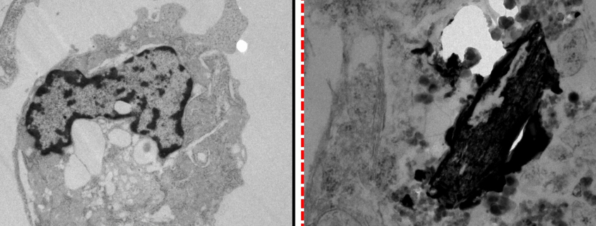 Una investigación de la Universidad de Murcia recibe el premio “Joaquín Moreno Clavel” por su contribución al estudio del impacto de la contaminación ambiental en la salud cardiovascular